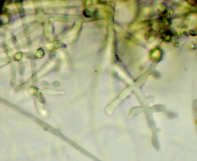 Clamydospore de Trichoderma viride